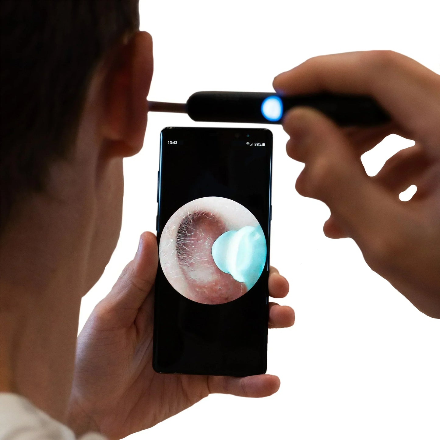 SYNERGY™ - PROFESSIONAL EAR WAX REMOVAL TOOL