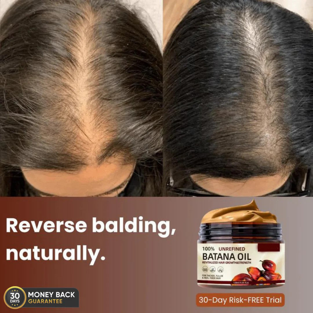 SYNERGY™ - 100% UNREFINED BATANA OIL (Buy 1 Get 1 Free)