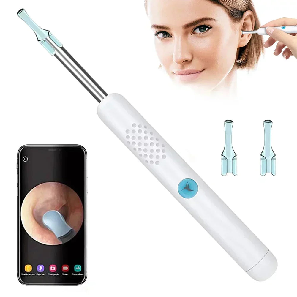 SYNERGY™ - PROFESSIONAL EAR WAX REMOVAL TOOL