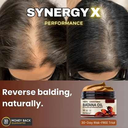 SYNERGY+ 100% UNREFINED BATANA OIL (Buy 1 Get 1 Free)