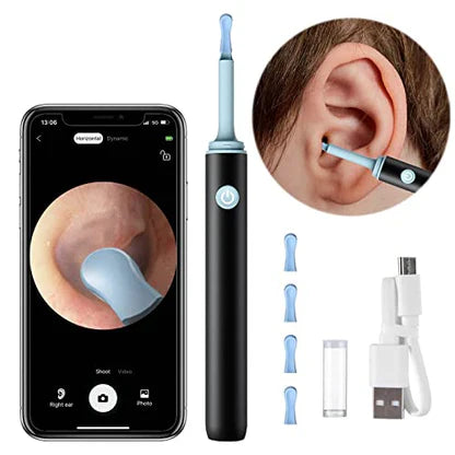 SYNERGY™   - PROFESSIONAL EAR WAX REMOVAL TOOL