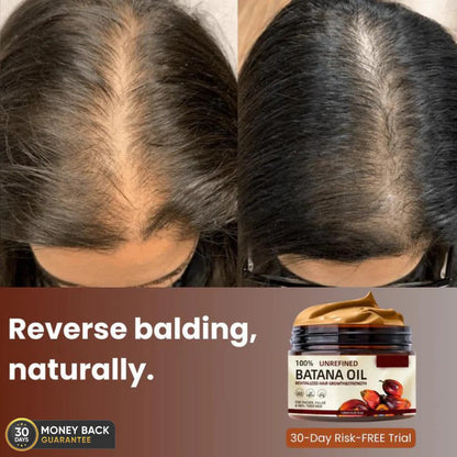 SYNERGY™  - 100% UNREFINED BATANA OIL (Buy 1 Get 1 Free)